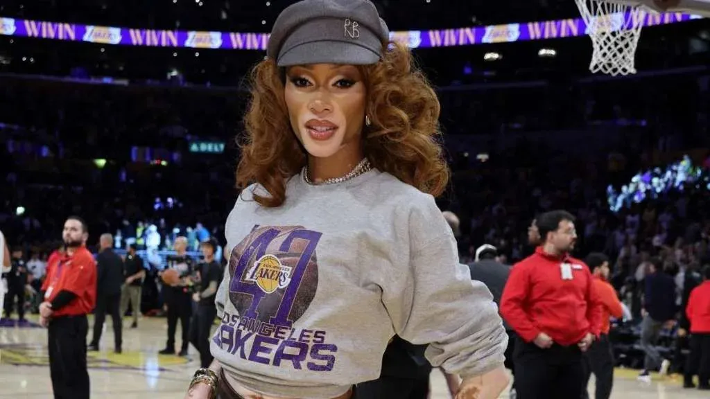 Winnie Harlow Stuns Fans with Her Mini-Skirt Outfit