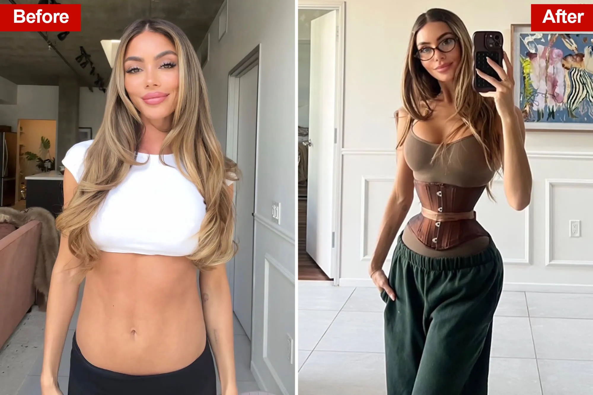 Young women spending big on risky rib removal surgery to achieve the dangerous 'Ozempic body' trend