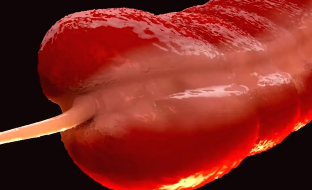 Experts are Baffled by the Increase of a Rare Cancer in Young People