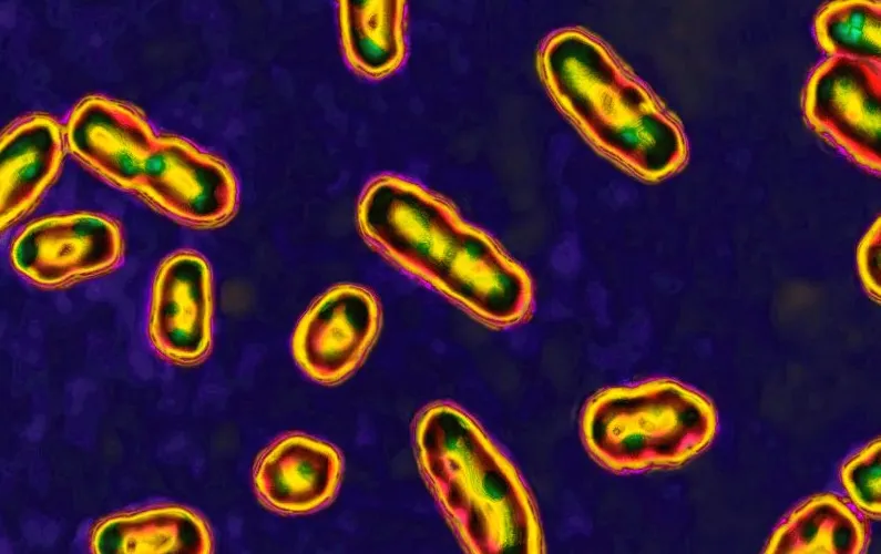 New research suggests that the Black Death was caused by a volcanic eruption