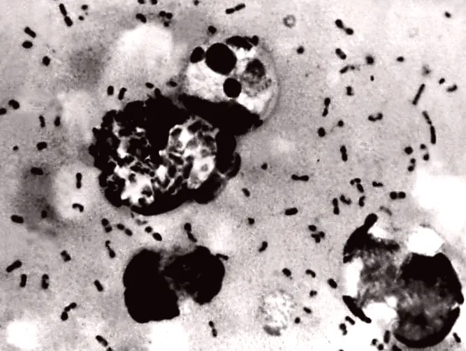 Volcanic eruptions could have introduced Black Death to Europe