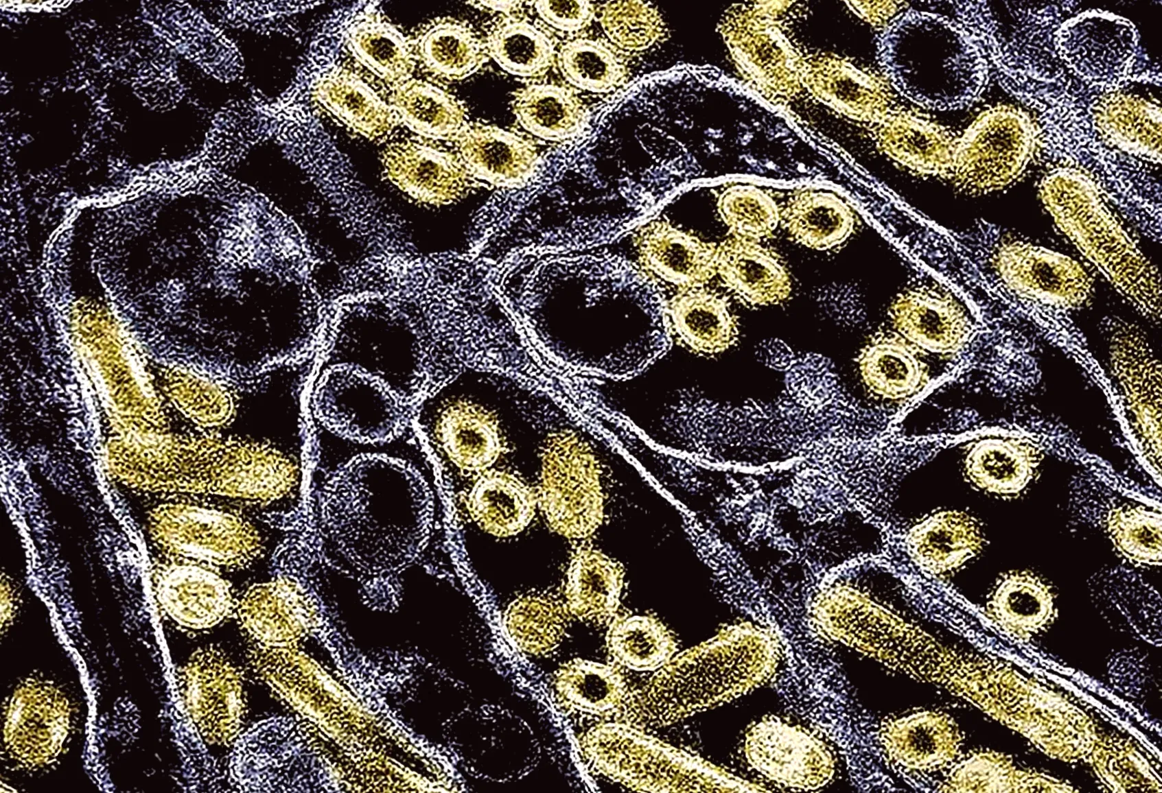 Study finds bird flu gene enhances its ability to survive human fever defences