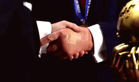 Trump's Swollen Hand After Injury