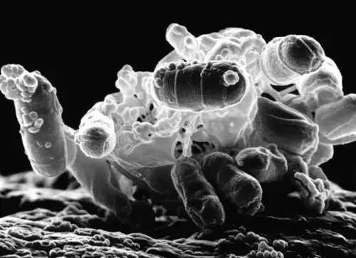 Antibiotics can induce bacteria to release inflammatory bubbles, complicating infection treatment.