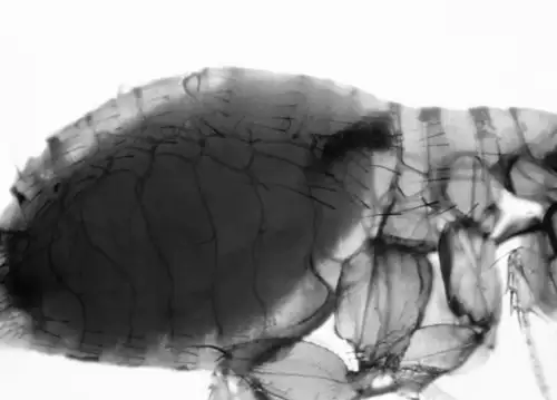 Health Officials Issue Warning About Flea-Borne Typhus Hospitalizing 90% of Infected Individuals